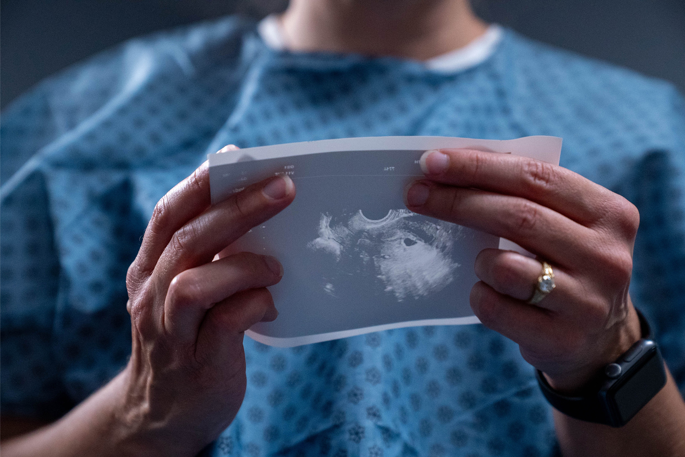 Closeup of a woman looking at an ultrasound image