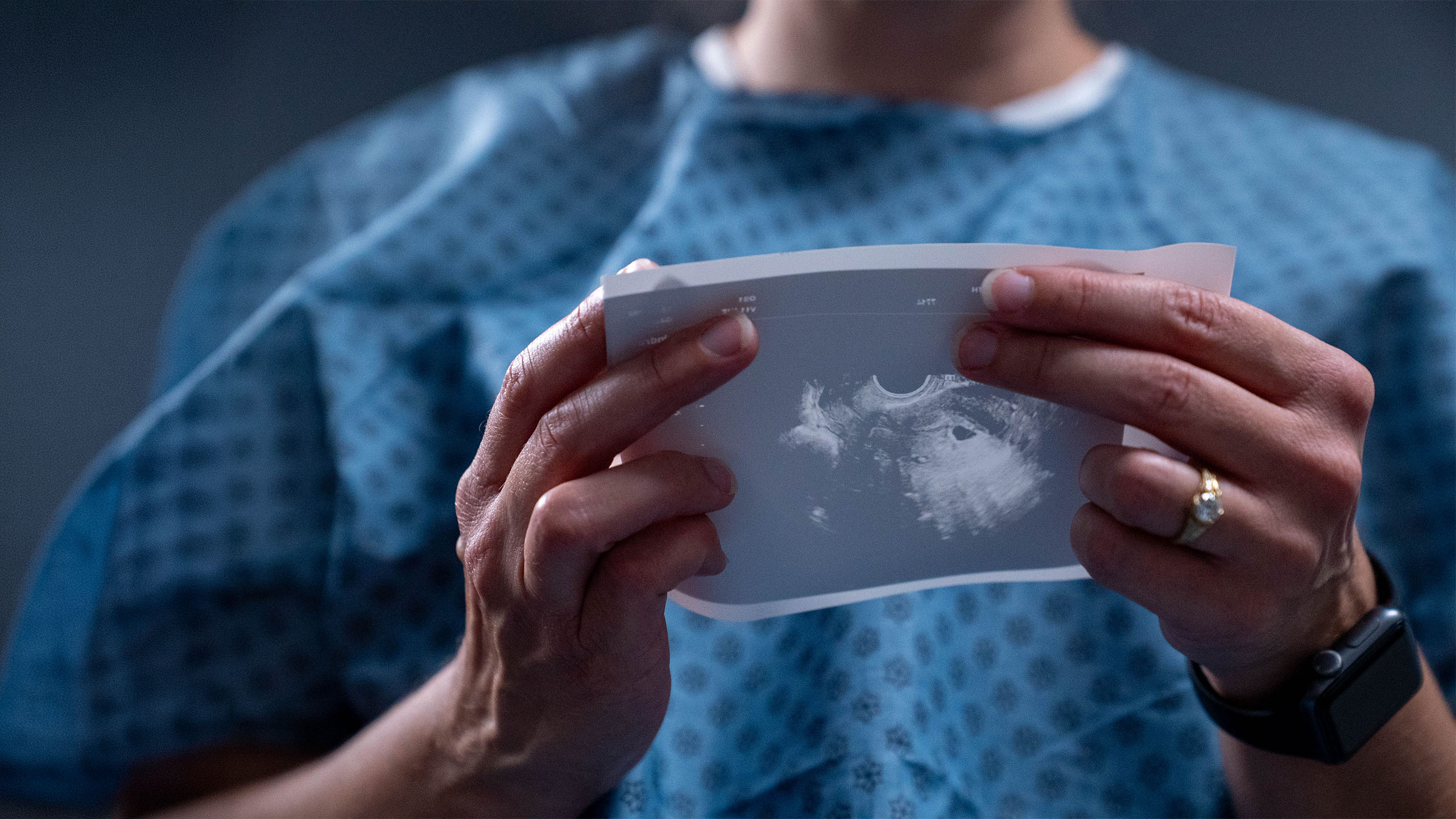 Closeup of a woman looking at an ultrasound image
